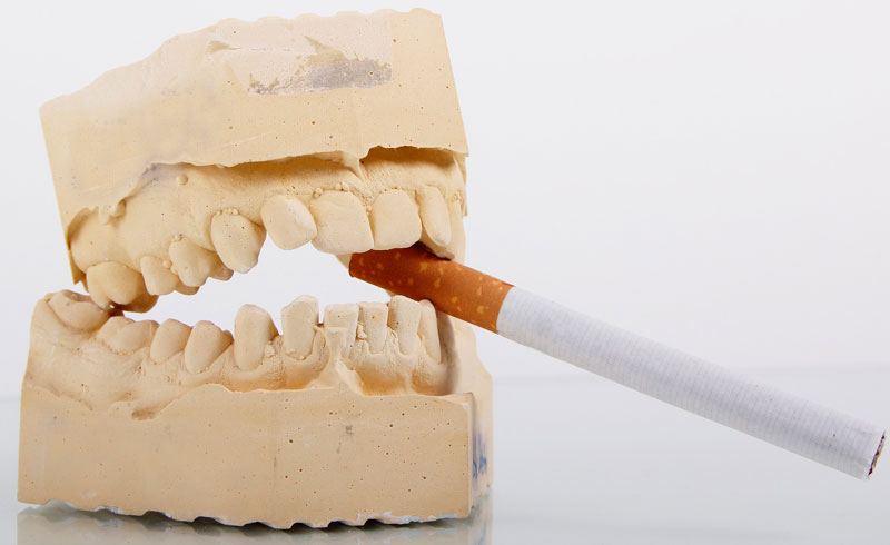 Los efectos del cigarrillo electrónico en los dientes