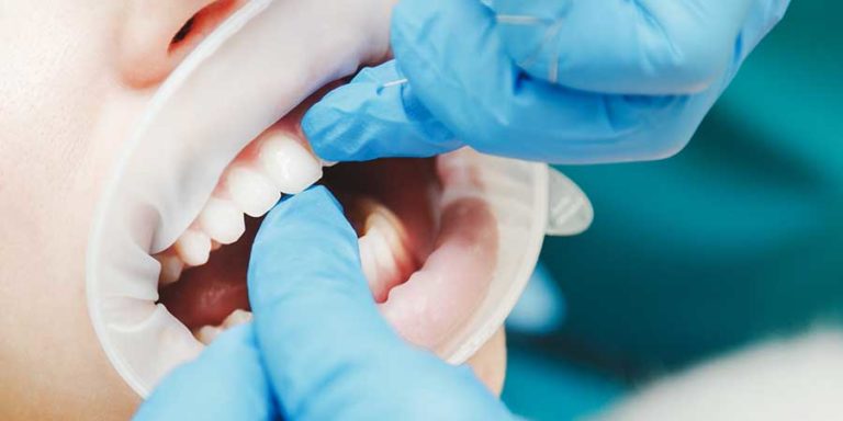 Qué características son importantes al elegir un cemento dental? 